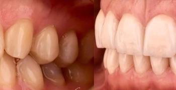 стоматологический туризм. польша